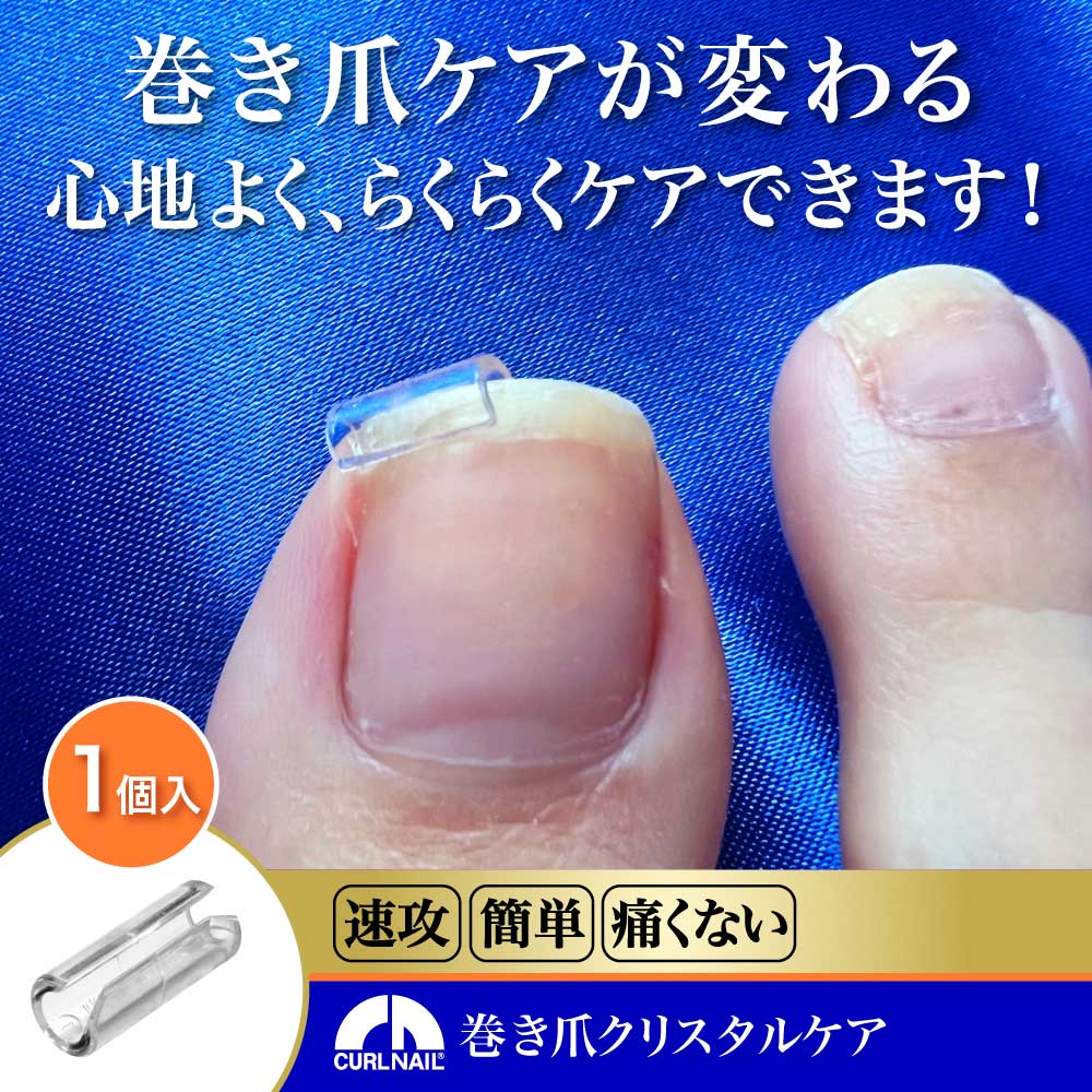 巻き爪 矯正 治し方 自分で 巻爪 爪切り 巻き爪クリスタルケア 1セット(お試し用1個入 軽度・中度用)