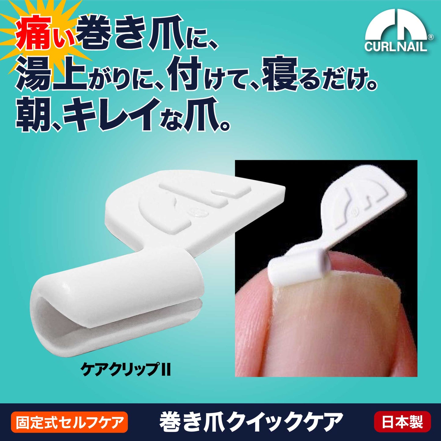 巻き爪クイックケア(軽度・中度の巻き爪用)カールネイル®クイックケアセット C-206