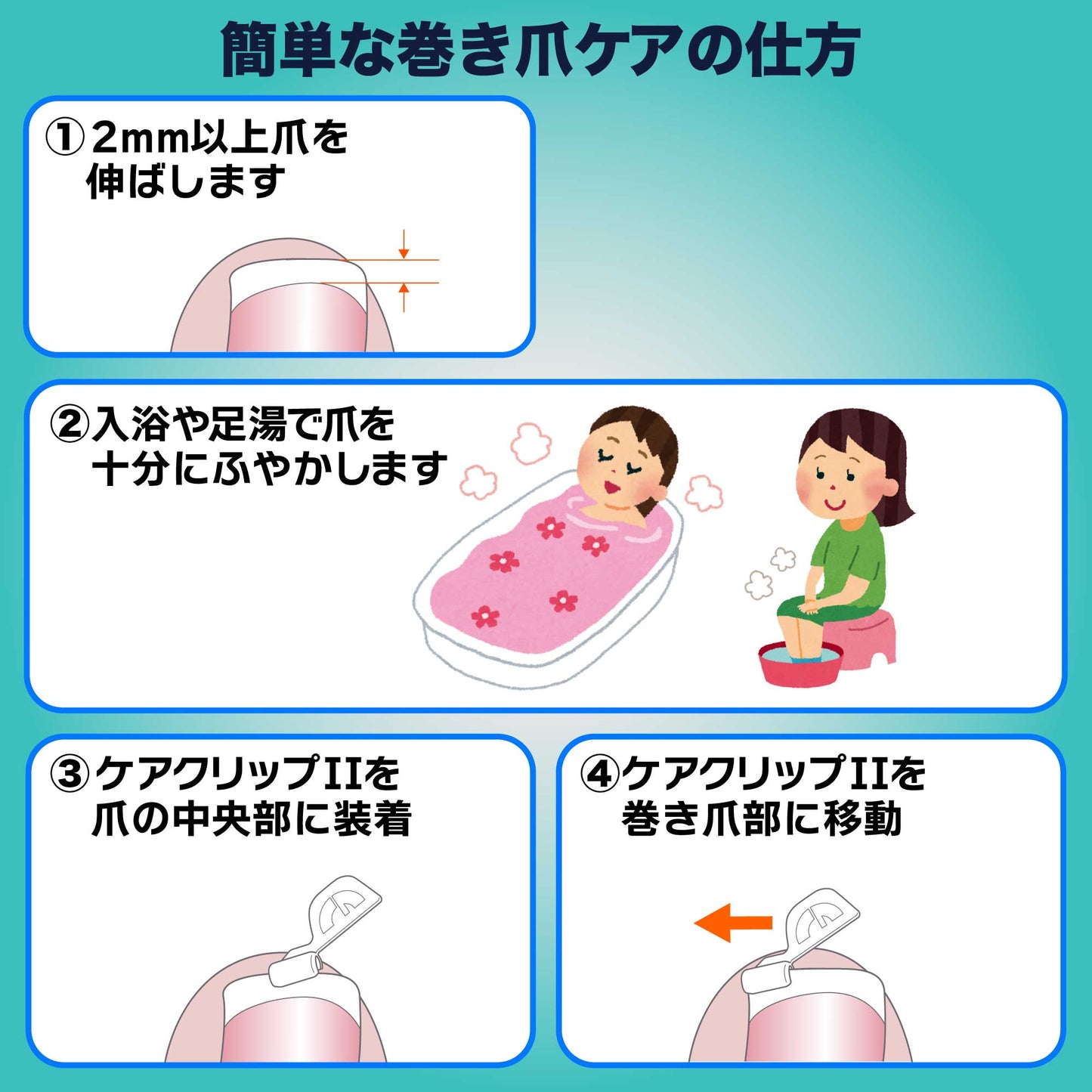 巻き爪クイックケア(軽度・中度の巻き爪用) カールネイル®クイックケアセット C-103