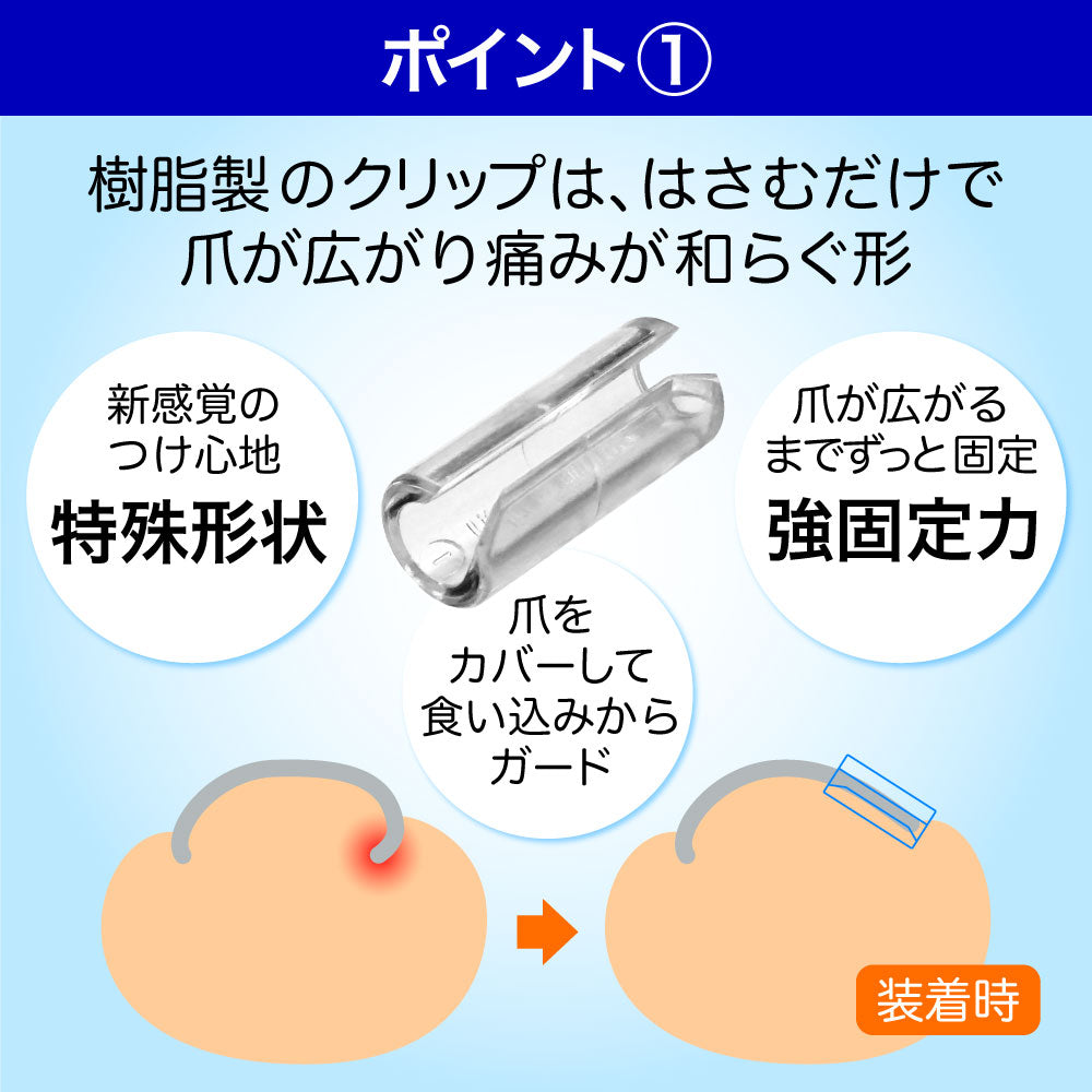 巻き爪 矯正 治し方 自分で 巻爪 爪切り 巻き爪クリスタルケア 1セット（お試し用1個入 軽度・中度用）