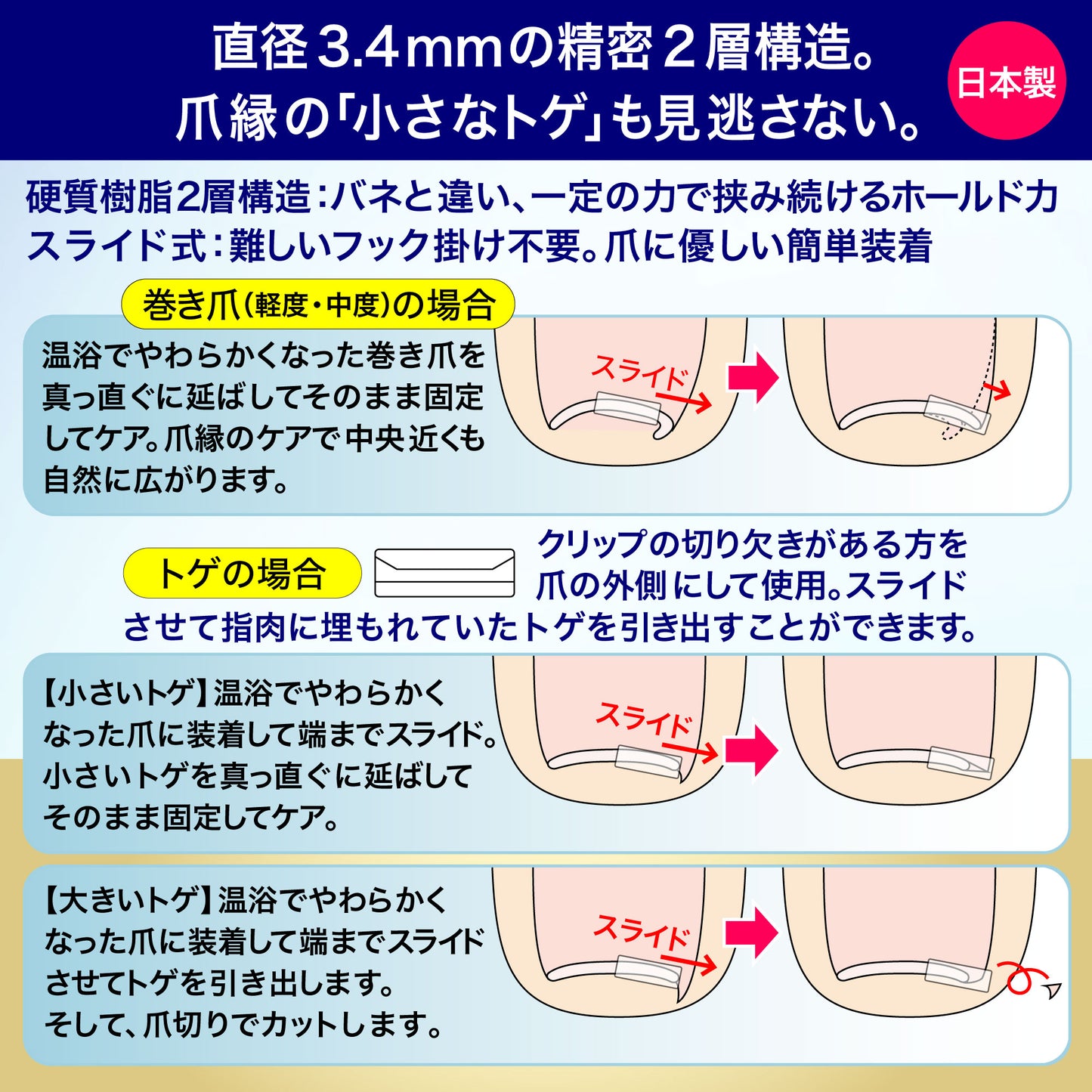 巻き爪もトゲも平らに固める【CURL NAIL 巻き爪クリスタルケア】日本製 巻き爪クリップ 自分で 自宅で ケア 痛くない まきづめ まきずめ setD(軽度・中度用 白1個入)